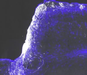 optic nerve injury - regenerating nerves