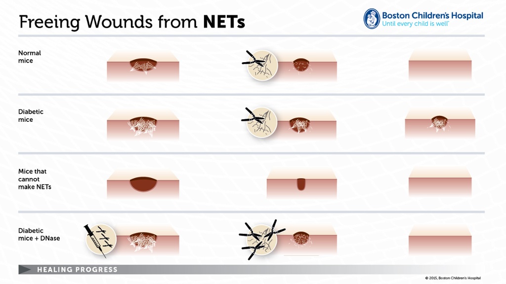 wounds and neutrophil extracellular traps (NETs)