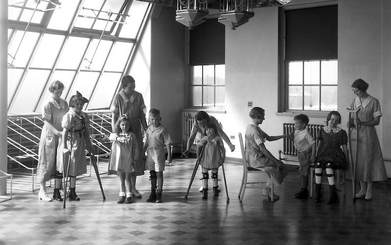 Children with polio receiving physical therapy.