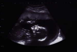 a sonogram