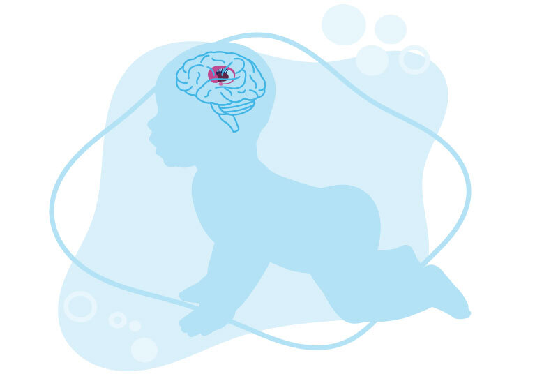 illustration of crawling baby emphasizing brain and globus pallidus within the brain