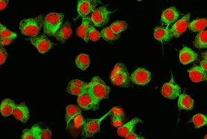 Human neuroblastoma cells.
