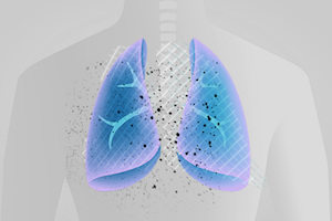 a drug used for cystic fibrosis is being tested in COVID-19 pneumonia 