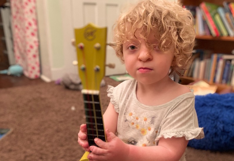 Maisie, who has Apert syndrome, holds a guitar