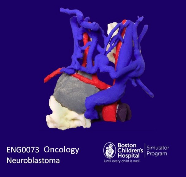 model of a neuroblastoma - SIMPeds