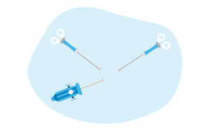 an abstract illustration of laparoscopic instruments