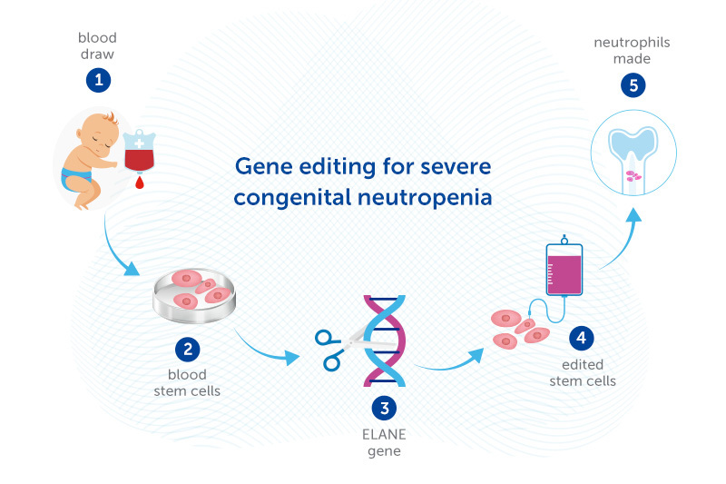 gene editing for severe congenital neutropenia