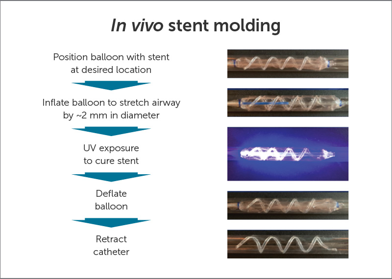 graph of how an adjustable airway stent works