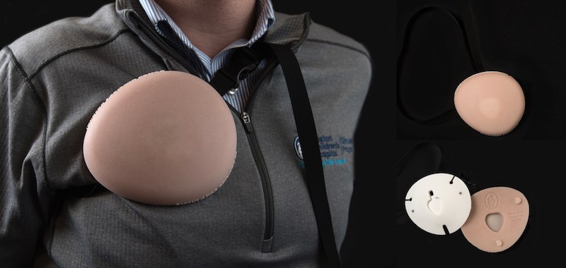 Wearable port-a-cath SIMPeds