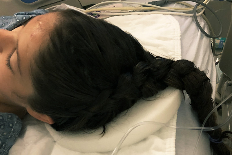 karlijn's braided hair after surgery to treat her seizures