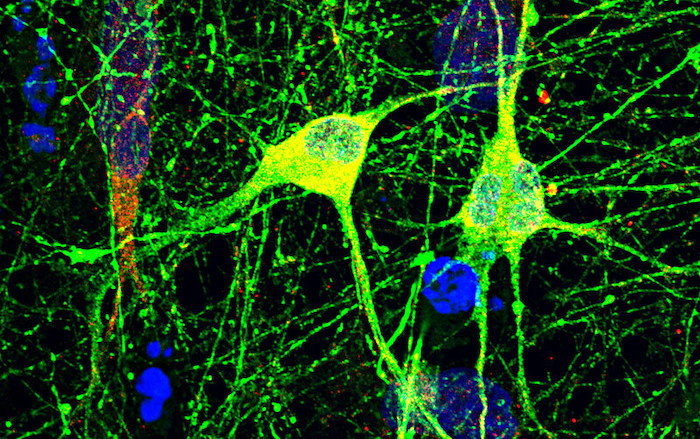 dopaminergic neurons with 16p11.2 deletion