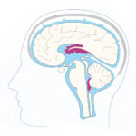 A cutaway view of the brain with the choroid plexus shown in the brain’s cavities, bathed by CSF.