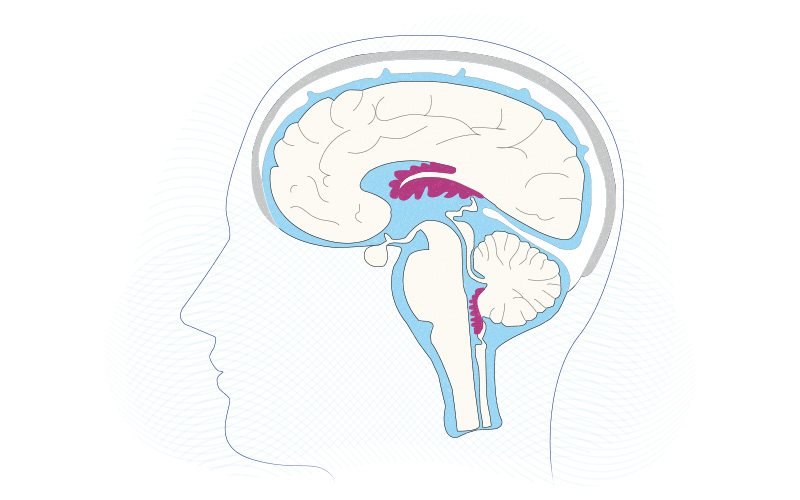 A cutaway view of the brain with the choroid plexus shown in the brain’s cavities, bathed by CSF.