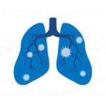 illustration of lungs with COVID virus infected