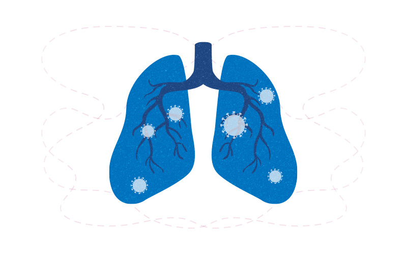 illustration of lungs with COVID virus infected