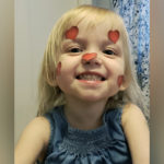 sarah, who has biliary atresia, smiles at the camera with heart stickers on her face