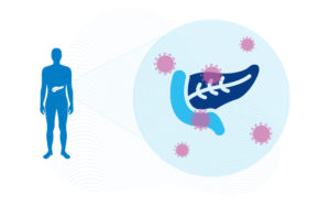 illustration of a pancreas surrounded by COVID19 virus particles