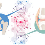 illustration of the genetics of joint disease - hip dysplasia and knee osteoarthritis