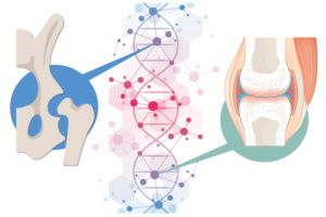 illustration of the genetics of joint disease - hip dysplasia and knee osteoarthritis