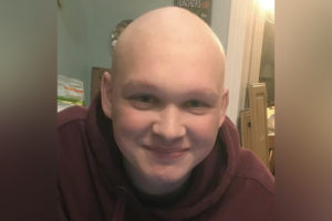 liam with his head shaved after treatment for liver cancer