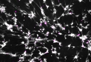 This image shows multiple neutrophil extracellular traps (NETs) and areas where the enzyme histone H3 is chemically modified, a key initiating step in NET formation.