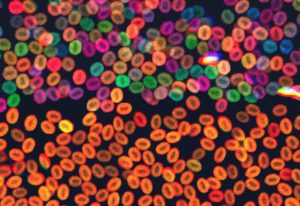 Color-coded blood stem cells showing healthy cells of diverse colors, and monochrome cells indicating clonal hematopoiesis.