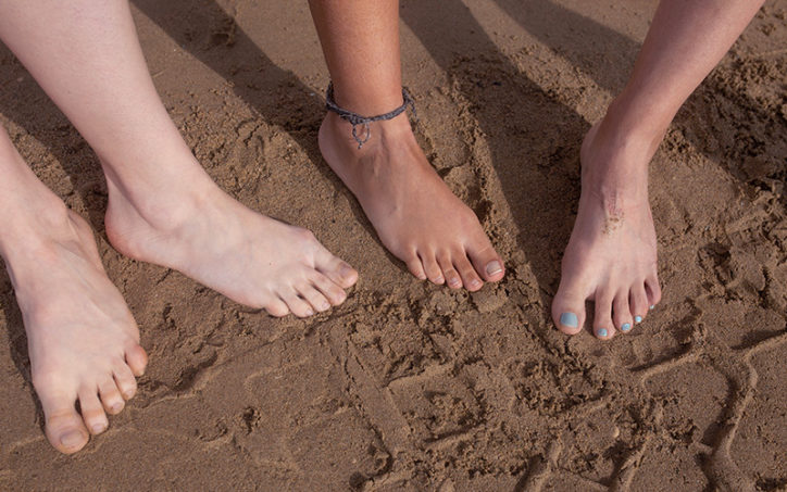 A teen with bunions stands with friends barefoot in the sand.
