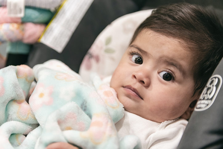 Baby Marcela looks at a well-wisher not long after surgery at Boston Children's Hospital.