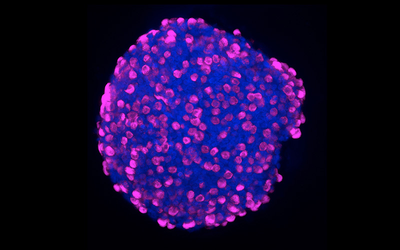 a roughly spherical group of thousands of cells growing together