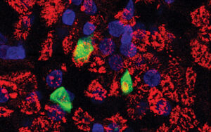 Under a microscope, a number of individual cells are seen. Those infected by SARS-CoV-2 stand out by appearing much brighter.
