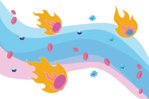 Illustration of monocytes in the bloodstream that appear to be on fire, igniting COVID-19 inflammation