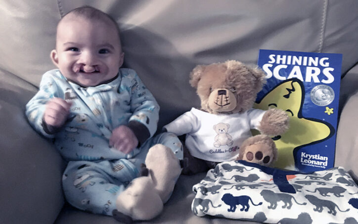In a photo taken when he was 4 months old, Logan Hatfield sits on a couch with a teddy bear and a copy of the book "Shining Scars."