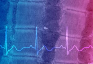 An electron microscopy image of heart muscle, with an EEG line superimposed.