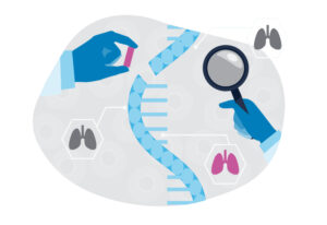 Conceptual illustration of cell therapy for lung disease, including genetic correction.