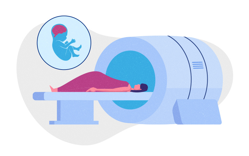 Illustration of a pregnant mother about to have an MRI scan, with a drawing of her fetus projected over her and highlighting the baby’s brain.