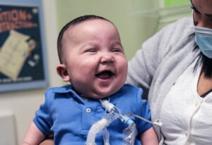 A smiling baby boy who who has a tracheostomy tube, sitting on a woman's lap.