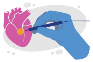 An illustration shows a surgeon's hand holding a confocal microscope near heart tissue.