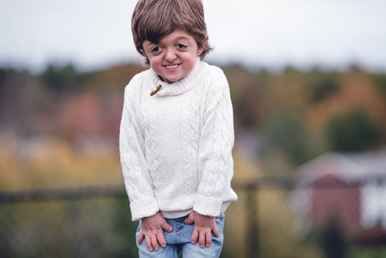 Weathering The Storm Of Apert Syndrome Jo o s Story weathering-the-storm-of-apert-syndrome-jo-o-s-story