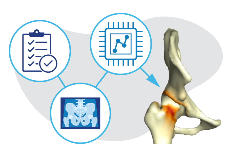 Clinical notes plus diagnostic imaging plus AI adds up to a 3D image of a patient's hip.