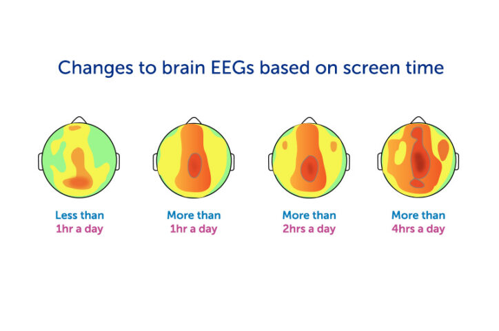 Rising EEG theta-wave intensity as daily screen hours increase: less than 1, more than 1, more than 2, more than 4.