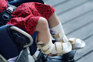 The legs of a little girl in a wheelchair.
