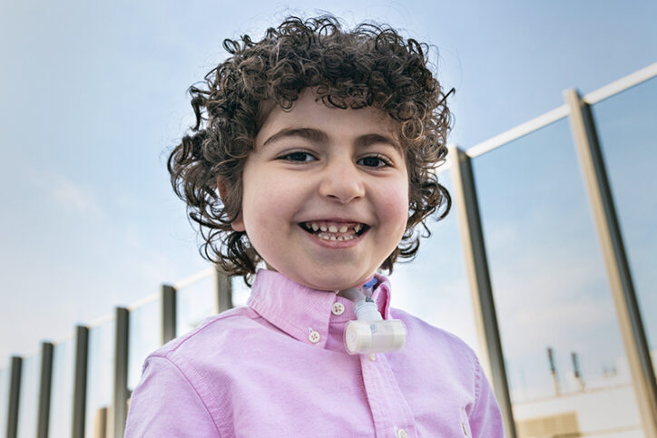 Sami smiles wide with a tracheostomy tube in his neck