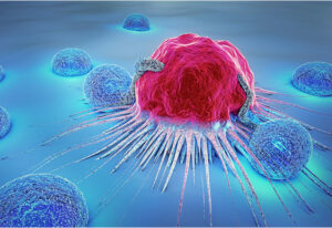 Natural killer cells attacking a tumor.