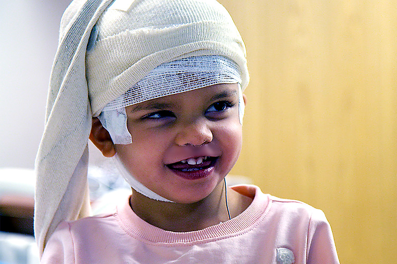 Alya with bandages around her head.