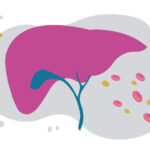 Illustration of a liver, surrounded by pink, yellow, and gray spots