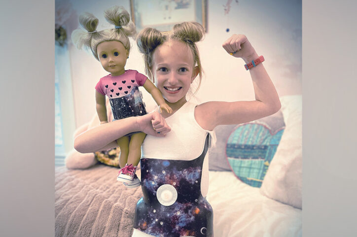Josie and her doll Rosie in matching scoliosis braces. 