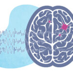 A brain with EEG waves and flashes indicating a seizure.