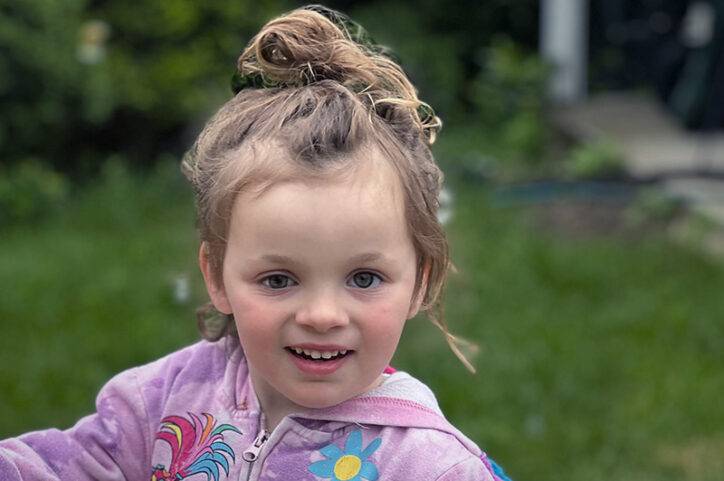 Lyla smiles as she wears her prosthetic eye after treatment for retinoblastoma