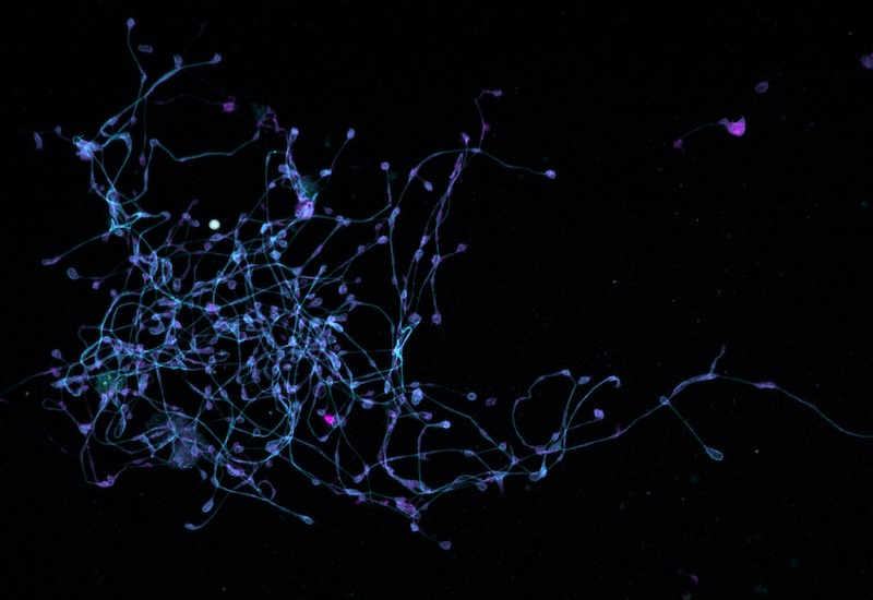 Megakaryocytes extending many long arms to make platelets.