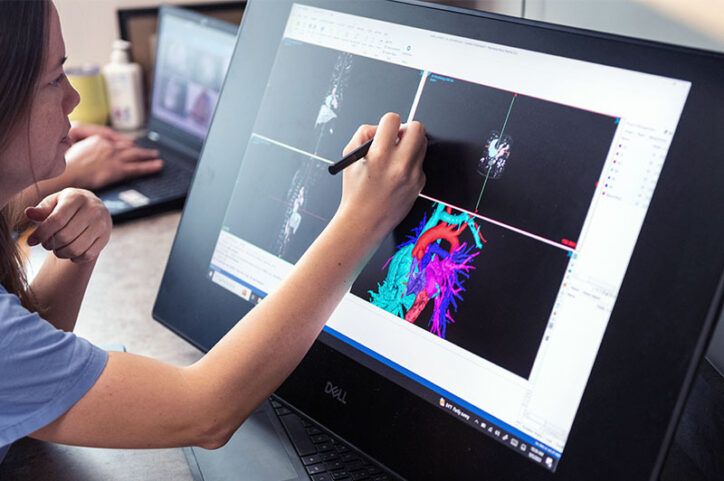 A medical device engineer uses a touchscreen pen on a monitor as she works on a patient's 3D heart model.